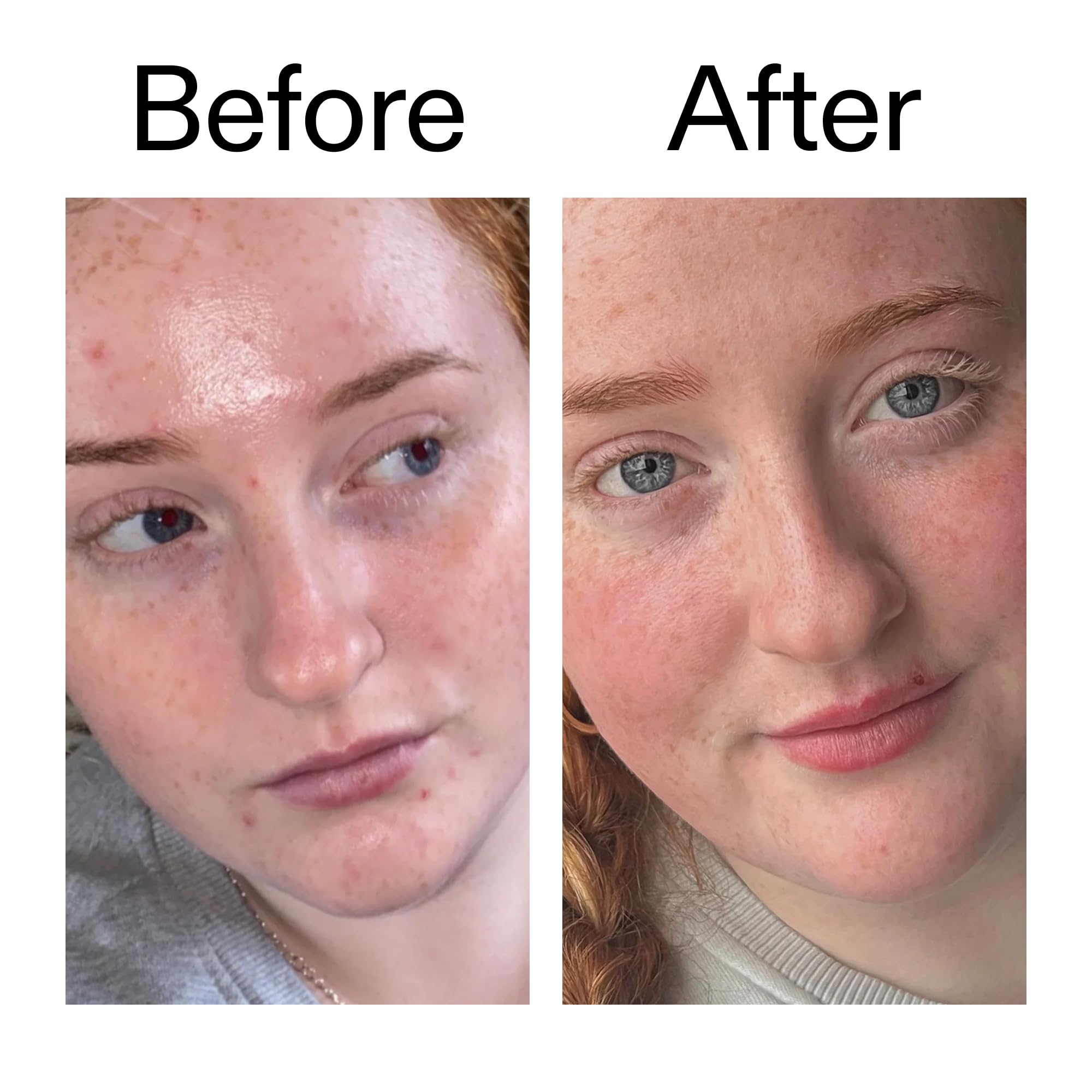 The INKEY List Vitamin B C E Moisturizer applied to clean skin for balanced care