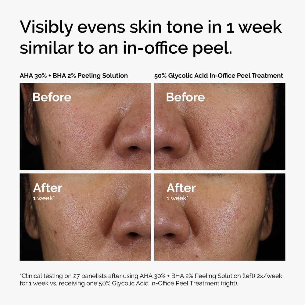 The Ordinary peeling solution being poured for application.