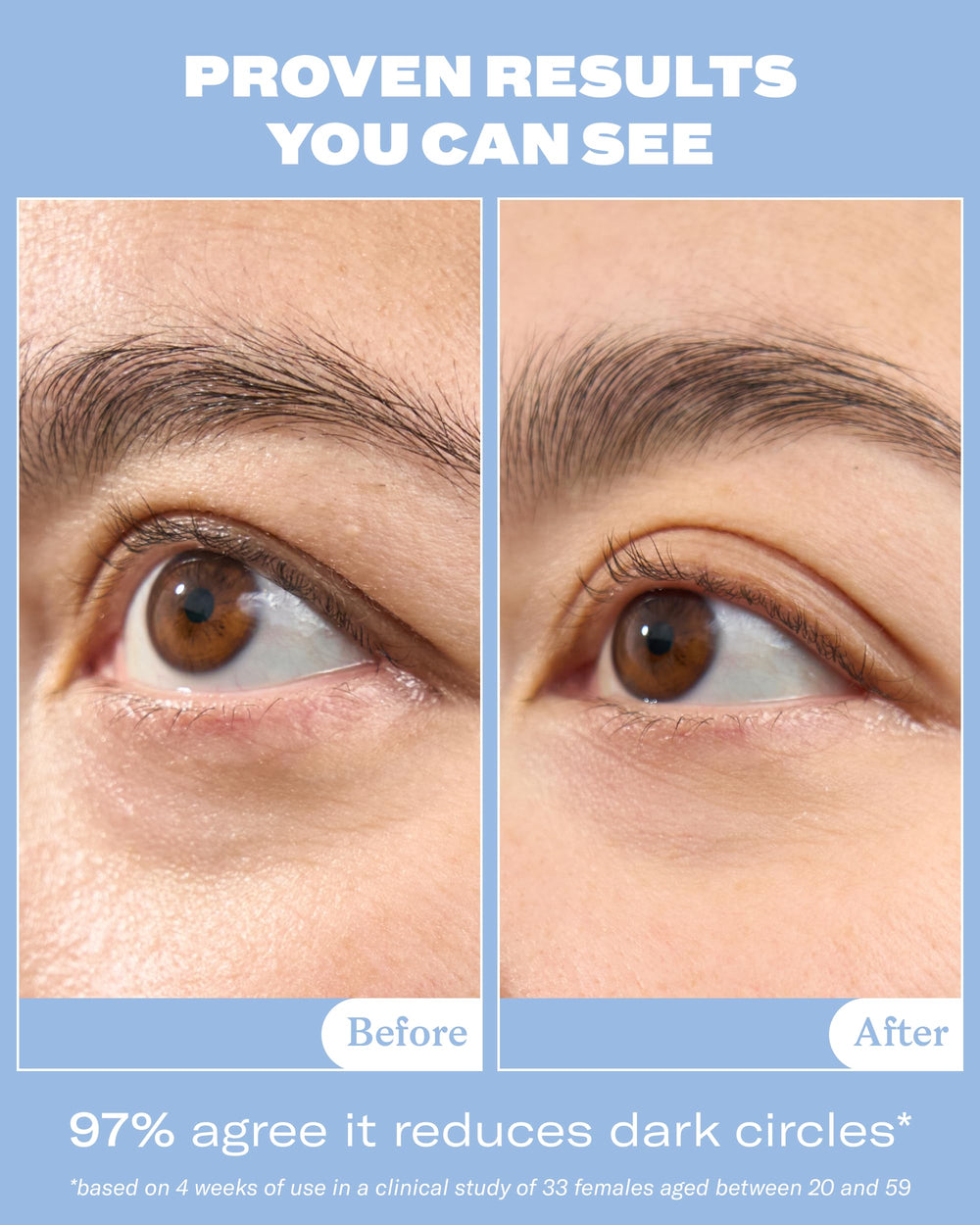 Then I Met You snail mucin eye cream texture close-up showing lightweight hydration.