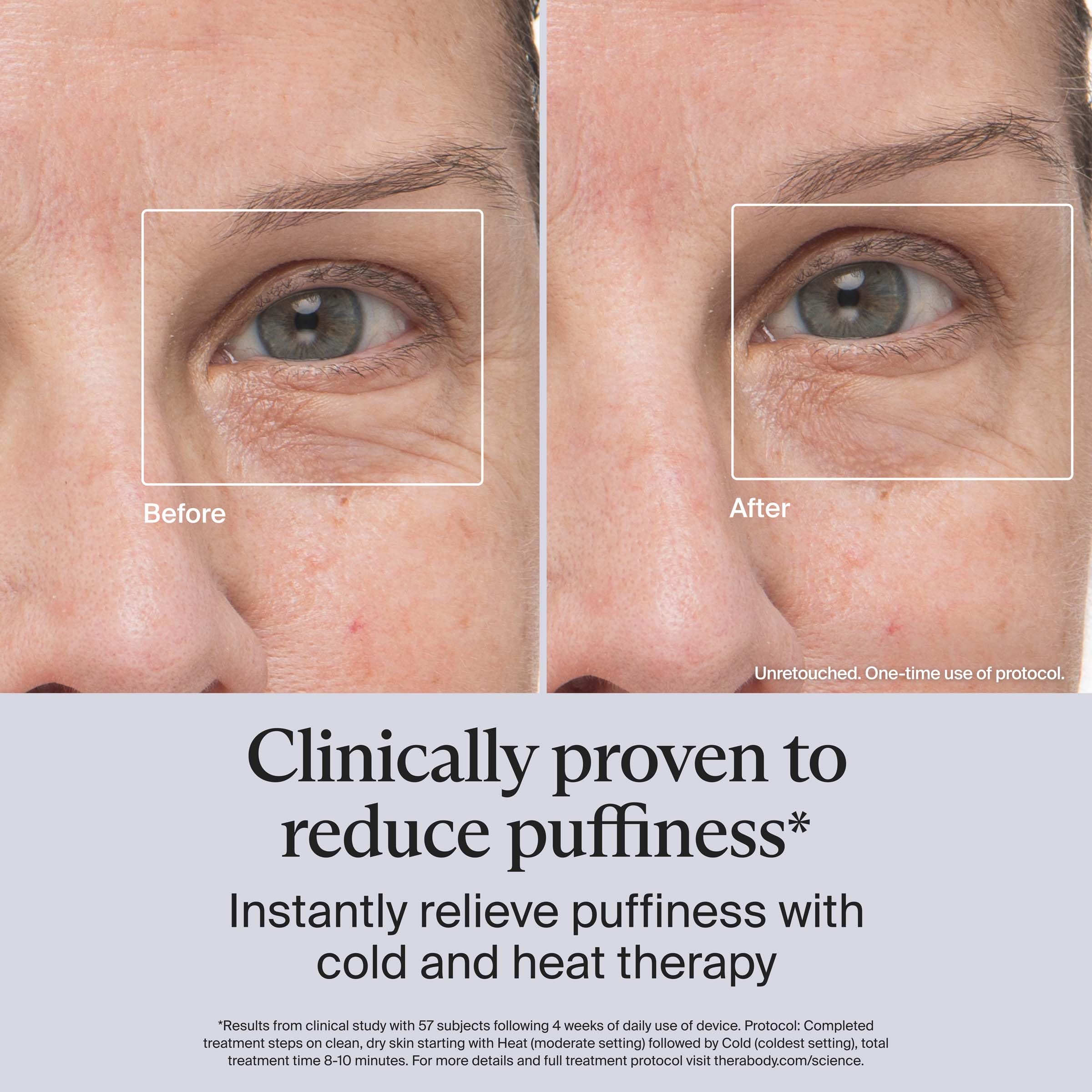 TheraFace eye-area tip closeup highlights precise depuffing around under-eye area