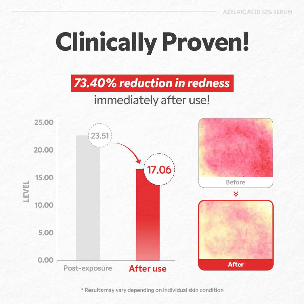 TIRTIR Azelaic Acid 12% serum zinc PCA and skincare science graphic.