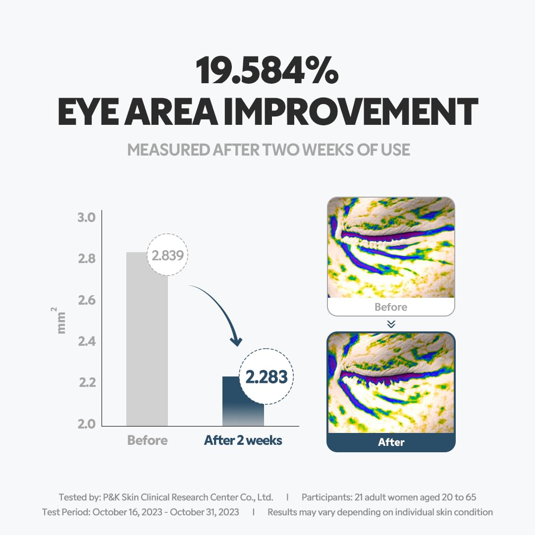 Morning application with the TIRTIR roller refreshes the eye area.