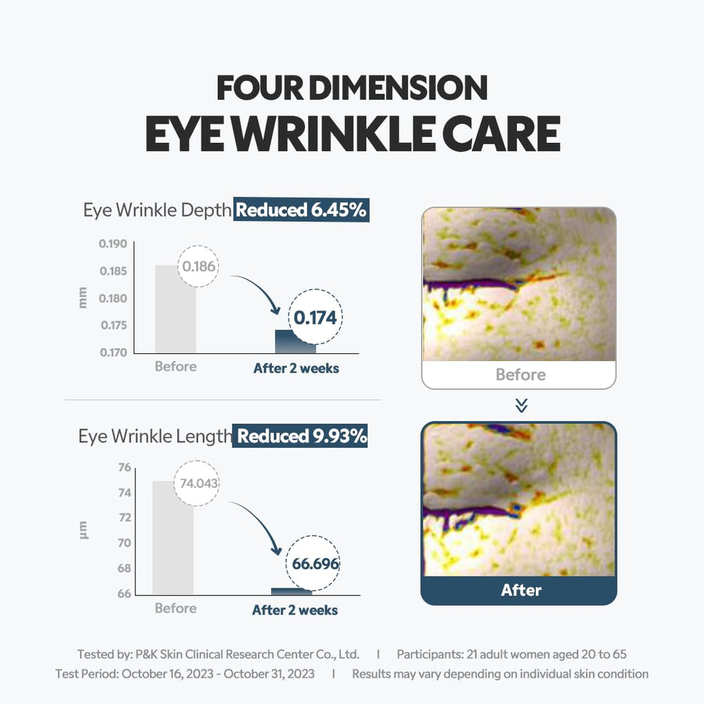 Night-time use of TIRTIR eye cream provides lightweight hydration.