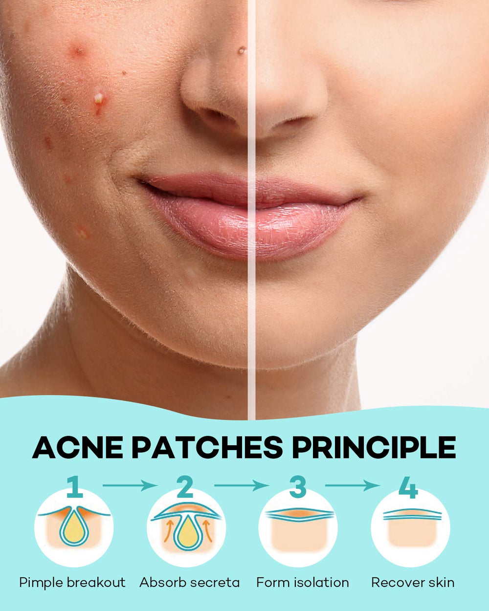 TKTK Pimple Patch overnight adhesion stays put during sleep