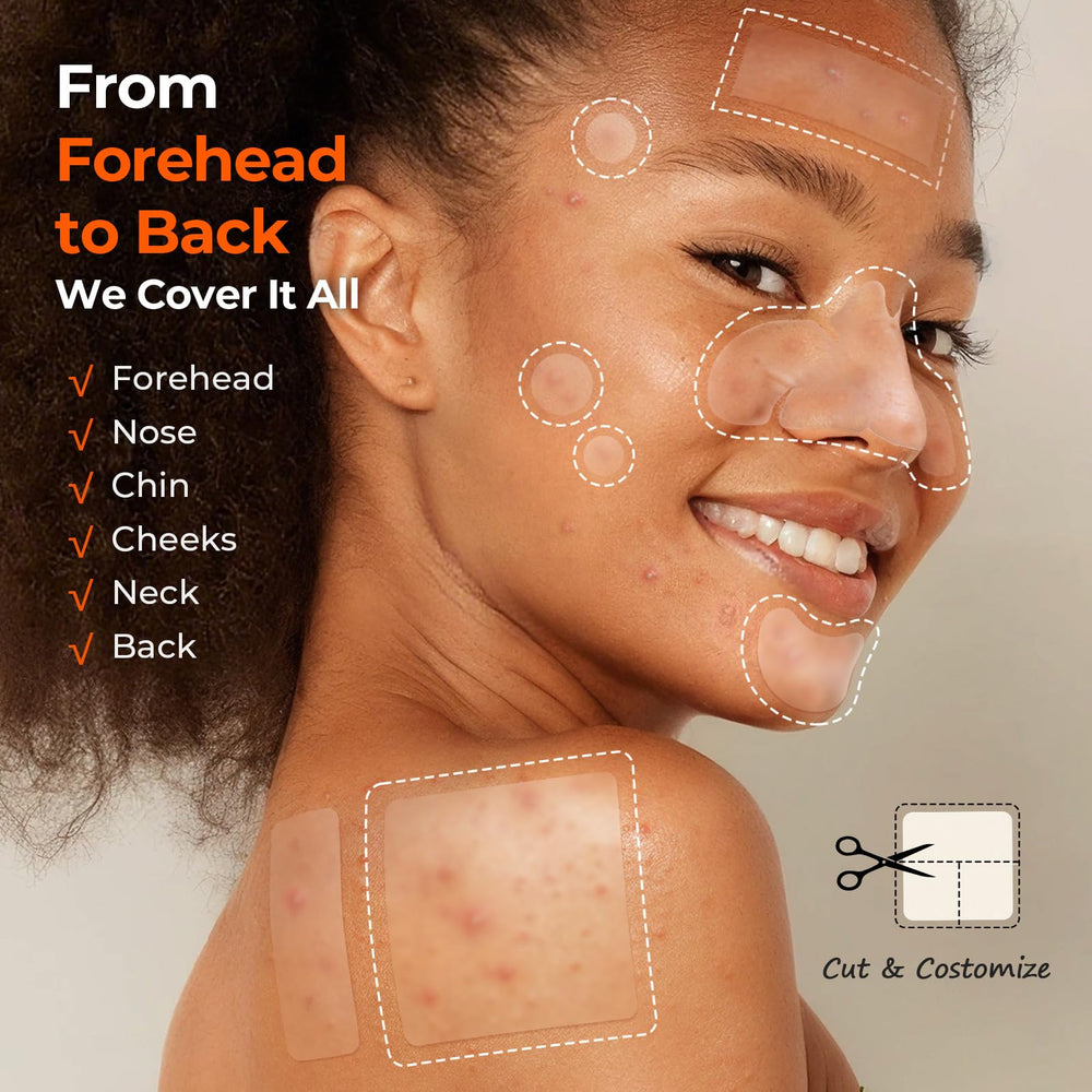 TKTK Pimple Patches 356-count packaging showcases value and convenience