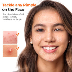 TKTK XL 60x30 mm pimple strip provides coverage for larger blemishes.