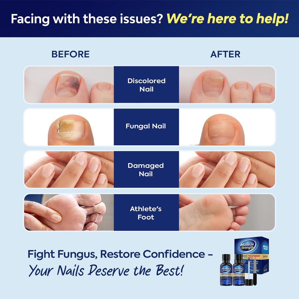 Tobcharm application on nail base and edges.