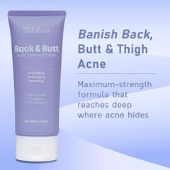 Tobcharm Butt Acne Routine shot demonstrates targeted application on problem areas