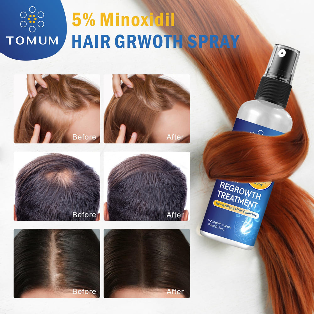 TOMUM Minoxidil bottle label with clear usage guidance.