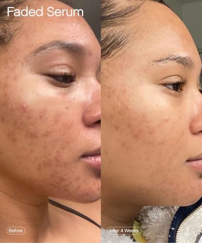 Graphic highlighting kojic acid, niacinamide, and azelaic acid in Topicals Faded Serum.