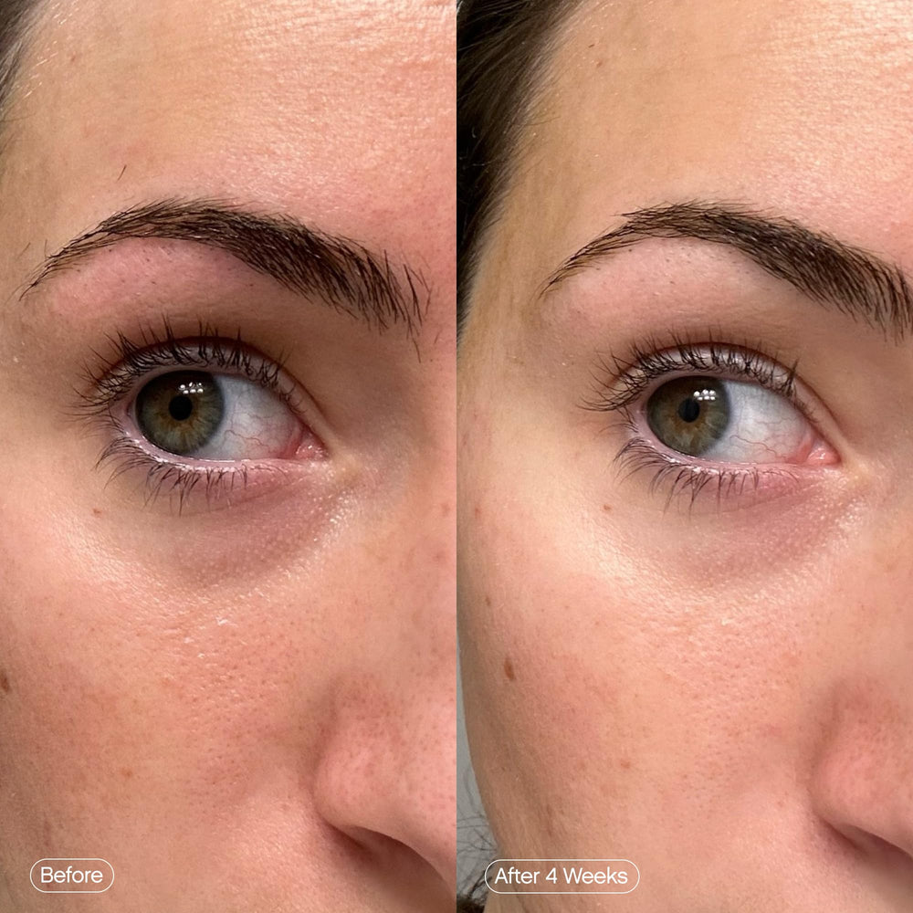Topicals Faded under-eye masks patches placed under the eyes during use.