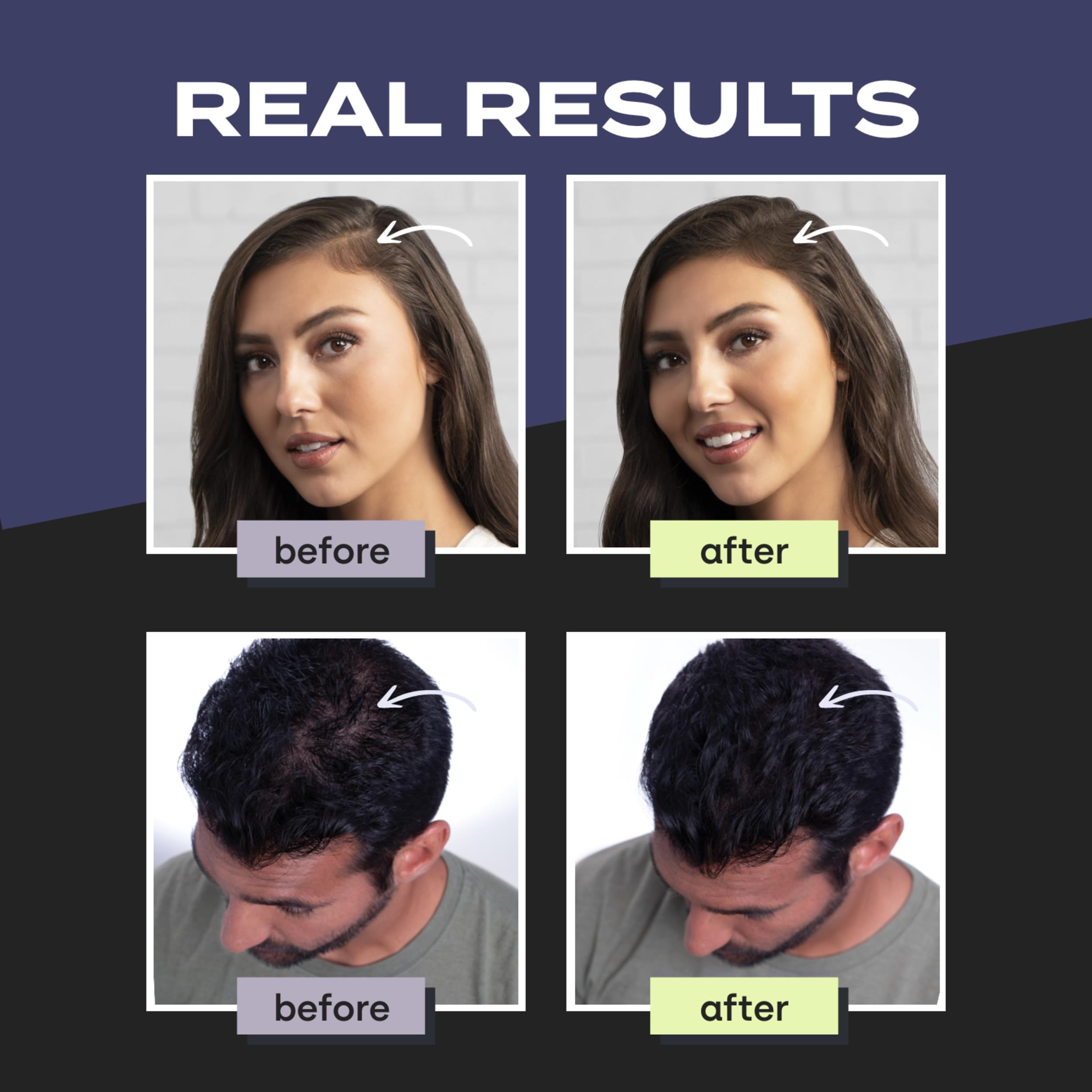 Toppik Hair Fibers root touch-up between colorings for seamless results
