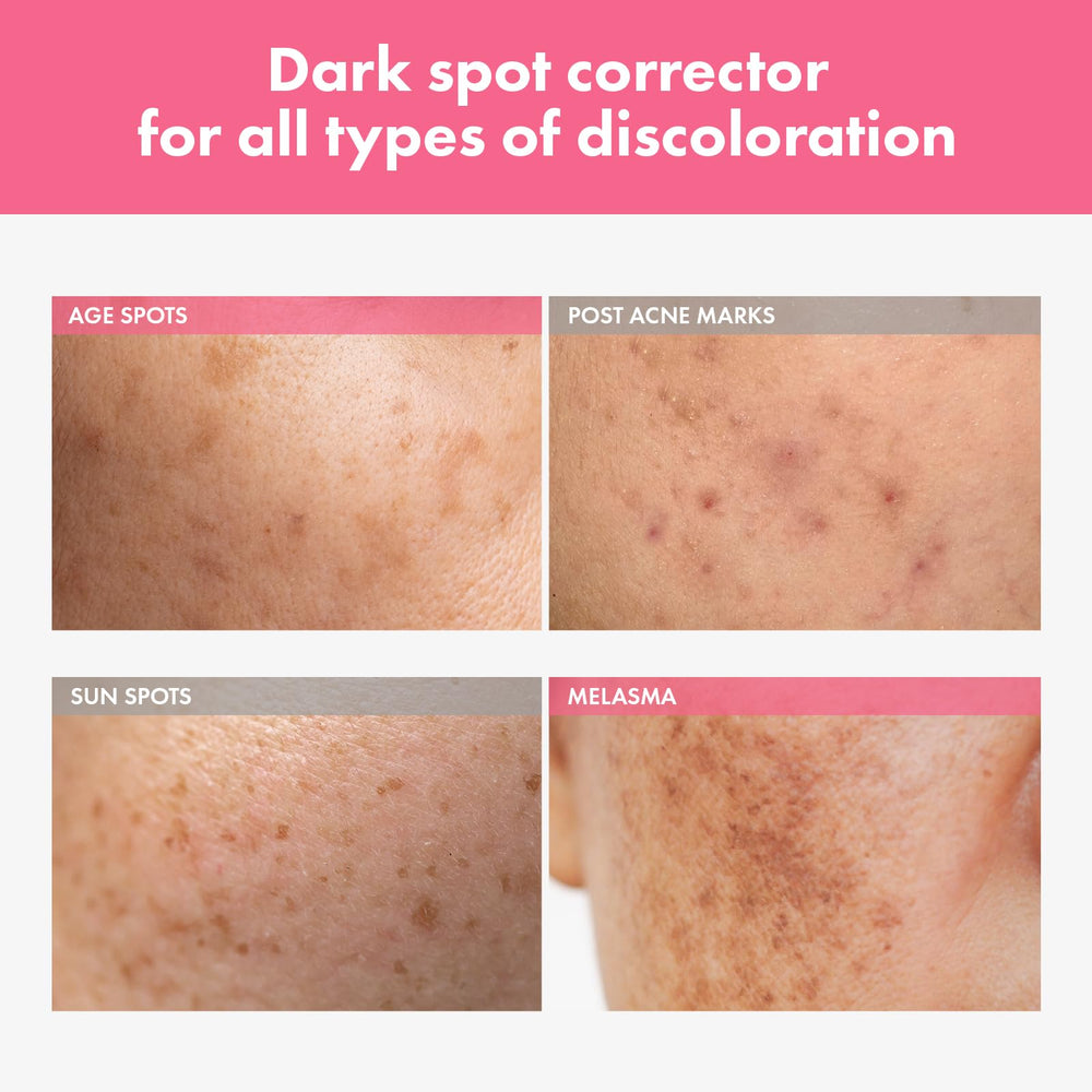 TOSOWOONG Arbutin 7-percent creamy texture close-up showing smooth application.