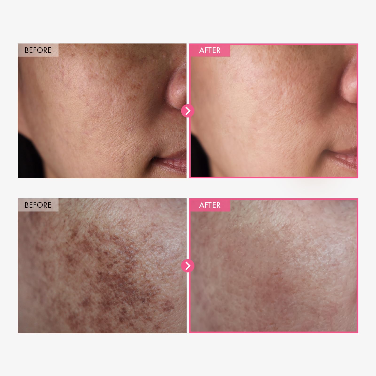 Tosowoong Arbutin Tranexamic Cream swatch highlights smooth texture for quick absorption.