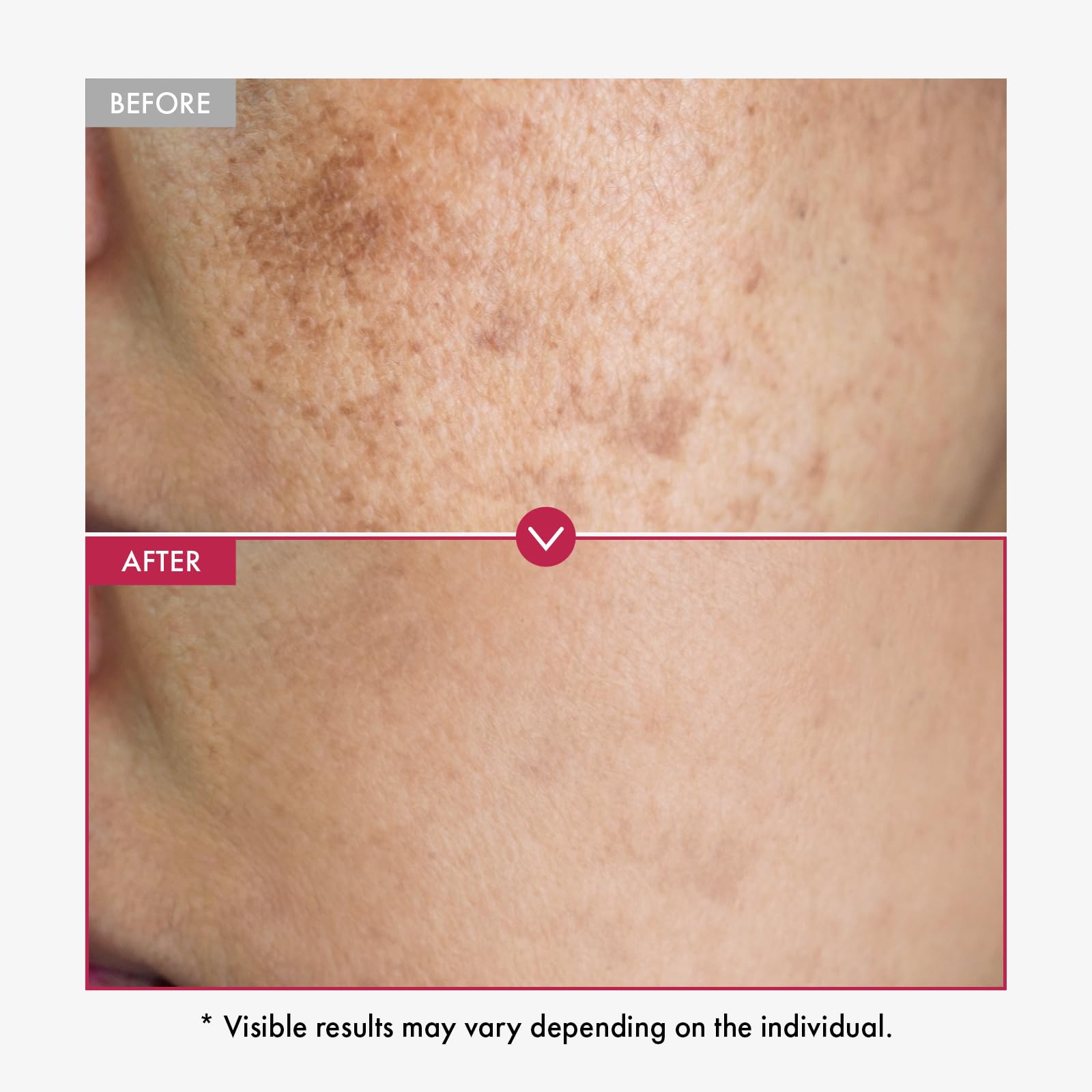 TOSOWOONG Niacinamide serum pink color hints at gentle, soothing hydration.