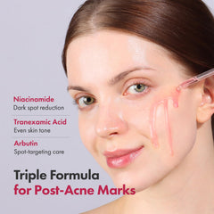 TOSOWOONG Niacinamide serum texture closeup shows lightweight, fast absorption.