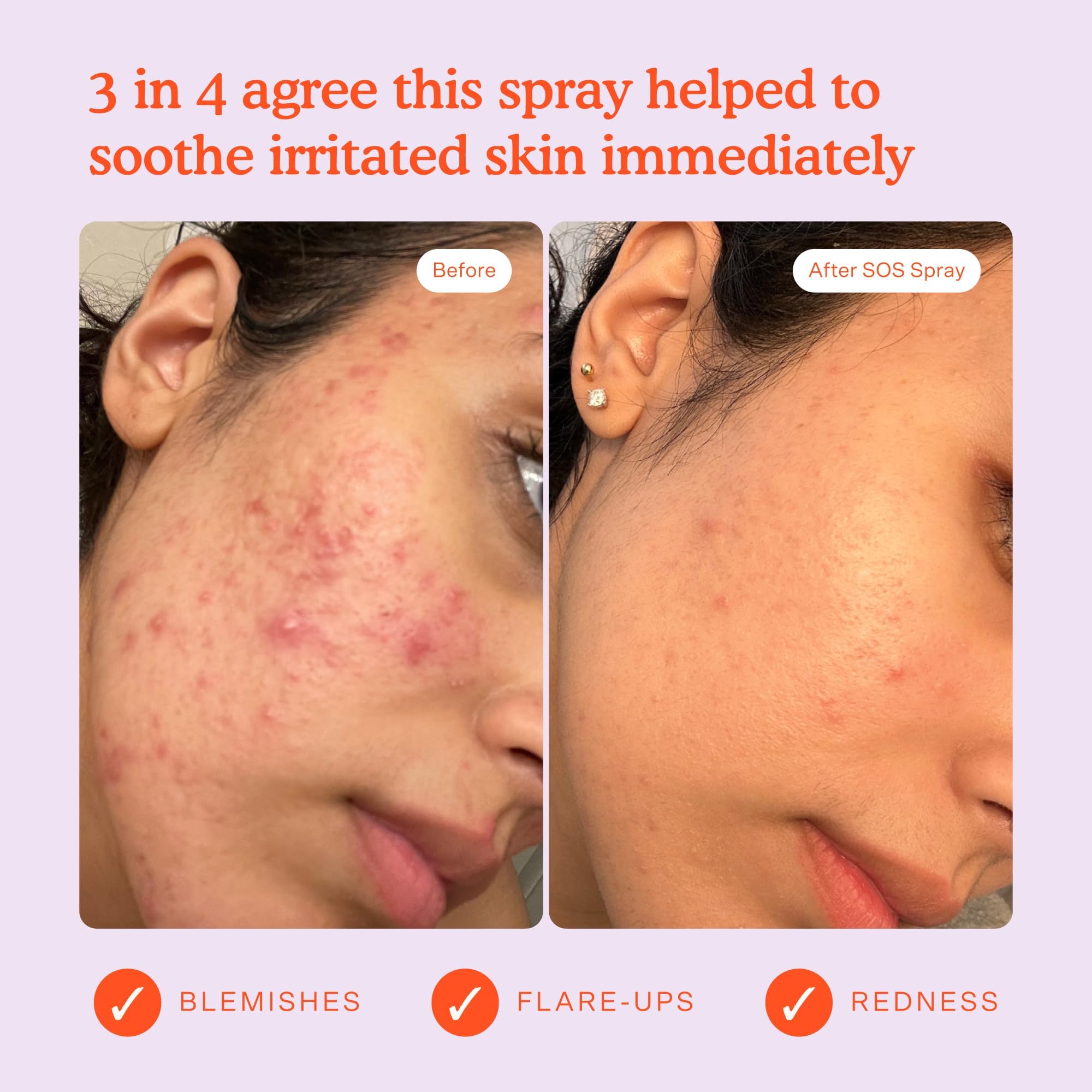 Tower 28 Jumbo SOS skin-friendly spray designed for sensitive skin.