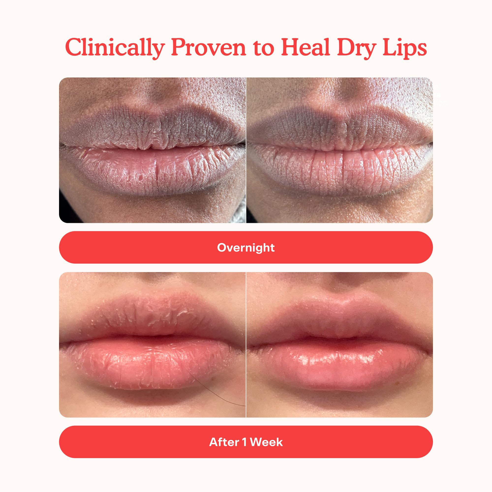 Tower 28 LipSoftie overnight-mask application nourishes lips while you sleep.