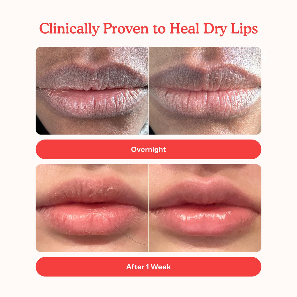 Tower 28 LipSoftie overnight-mask application nourishes lips while you sleep.