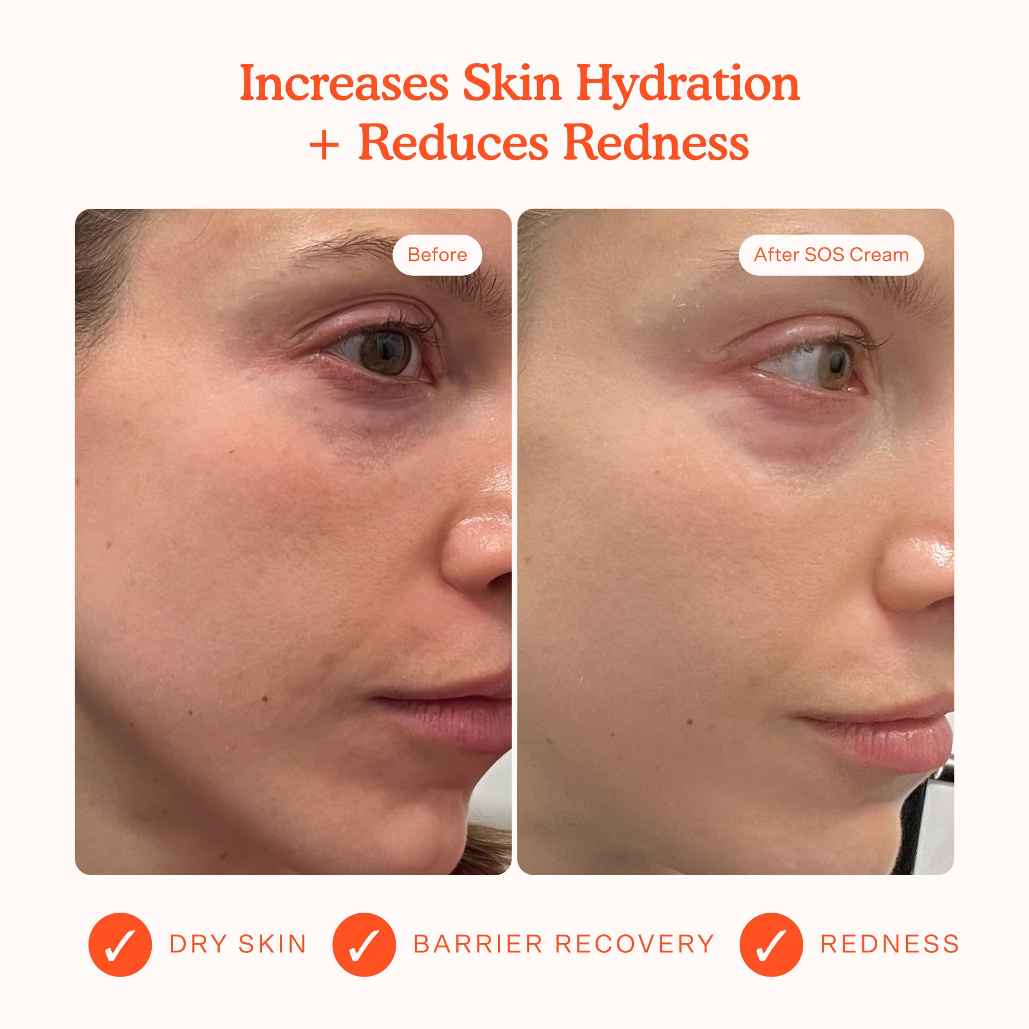 Tower 28 SOS Recovery Face Cream texture swirl reveals fast absorbing hydration