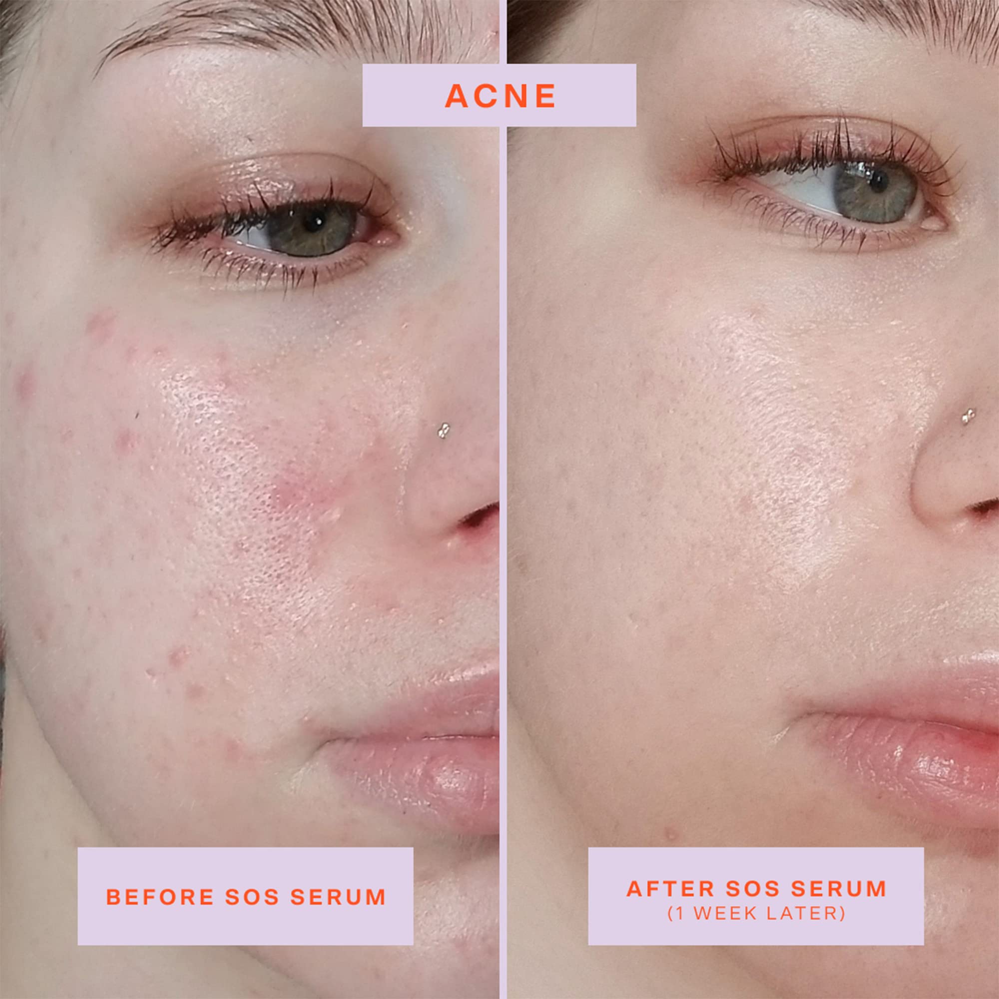 Tower 28 SOS Rescue Face Serum pump close-up, easy and precise application.