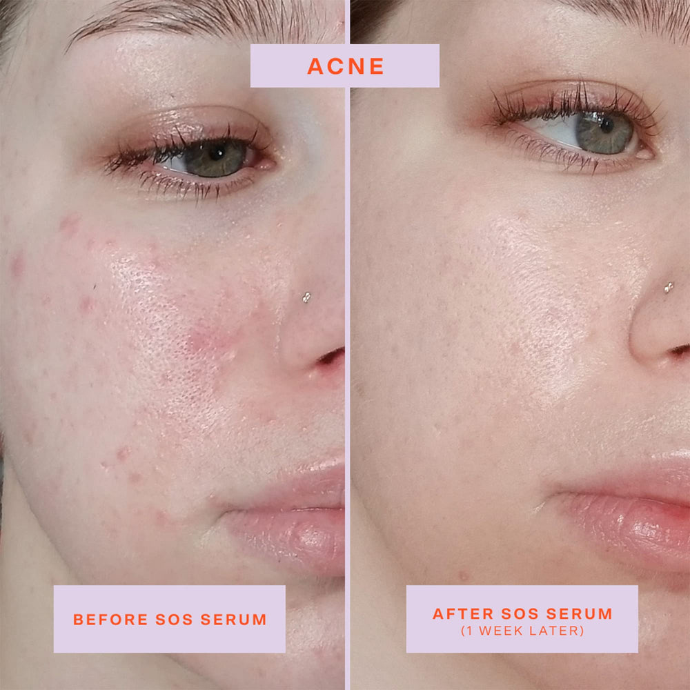 Tower 28 SOS Rescue Face Serum pump close-up, easy and precise application.
