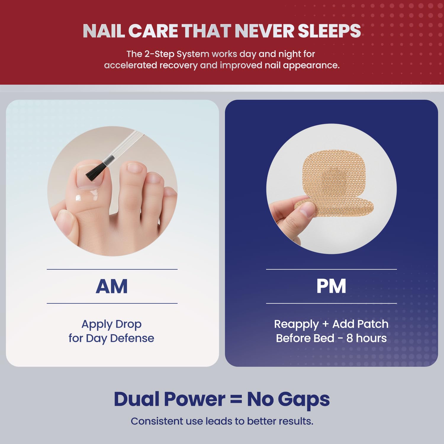 Nails after treatment appearing clearer and healthier.