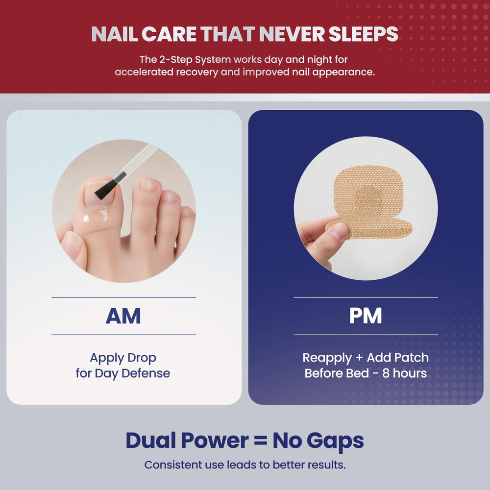 Nails after treatment appearing clearer and healthier.
