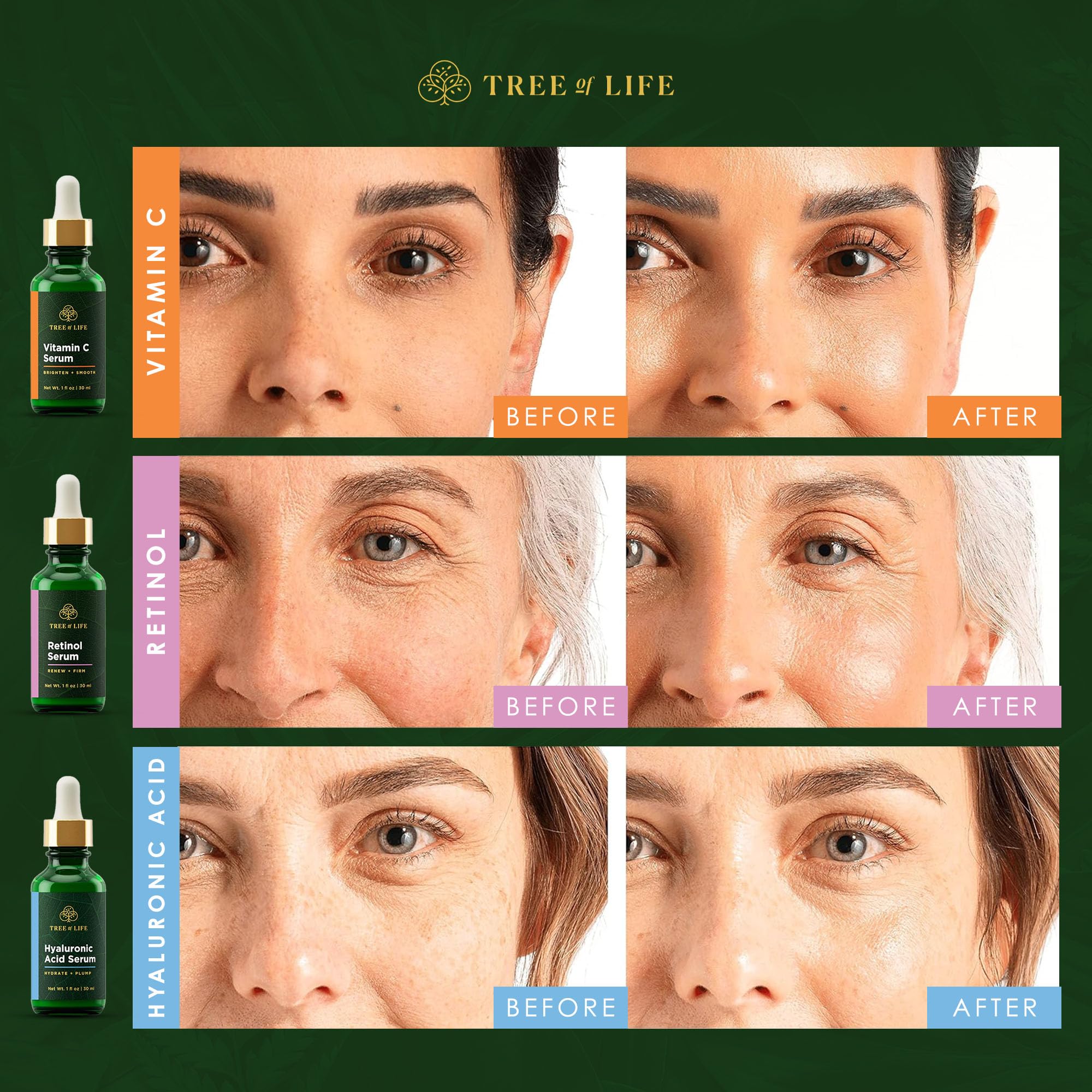 Tree of Life dry and sensitive skin routine with travel-friendly kit.