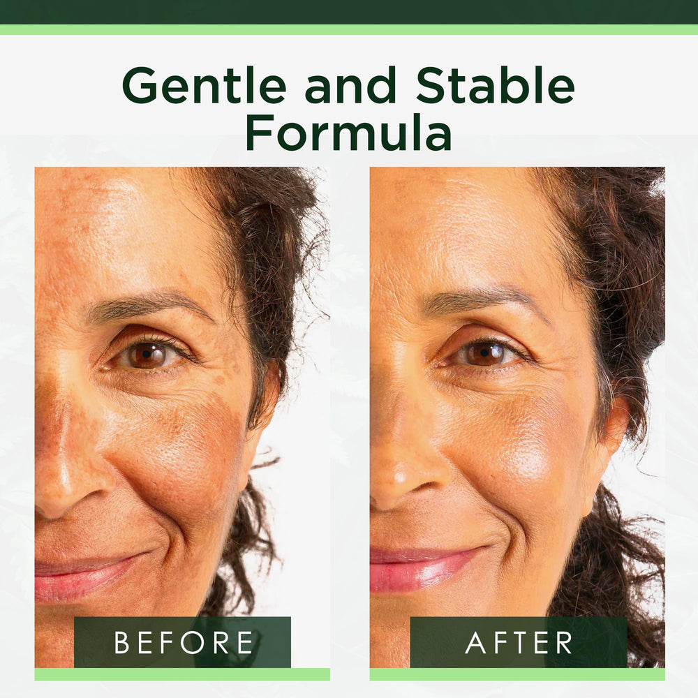 Tree of Life Niacinamide Serum texture on skin for even tone.