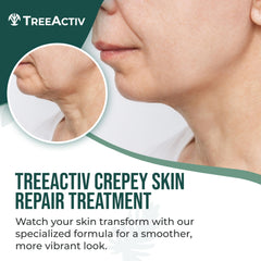 TreeActiv Crepey Skin Repair Cream texture close-up showing refined skin feel.