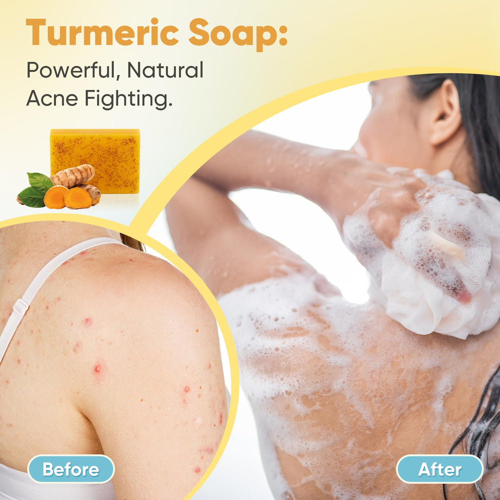 Treeroot turmeric soap ingredients list highlights natural purity
