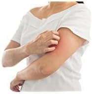 Front-line anti-itch Globe ointment in use for quick comfort