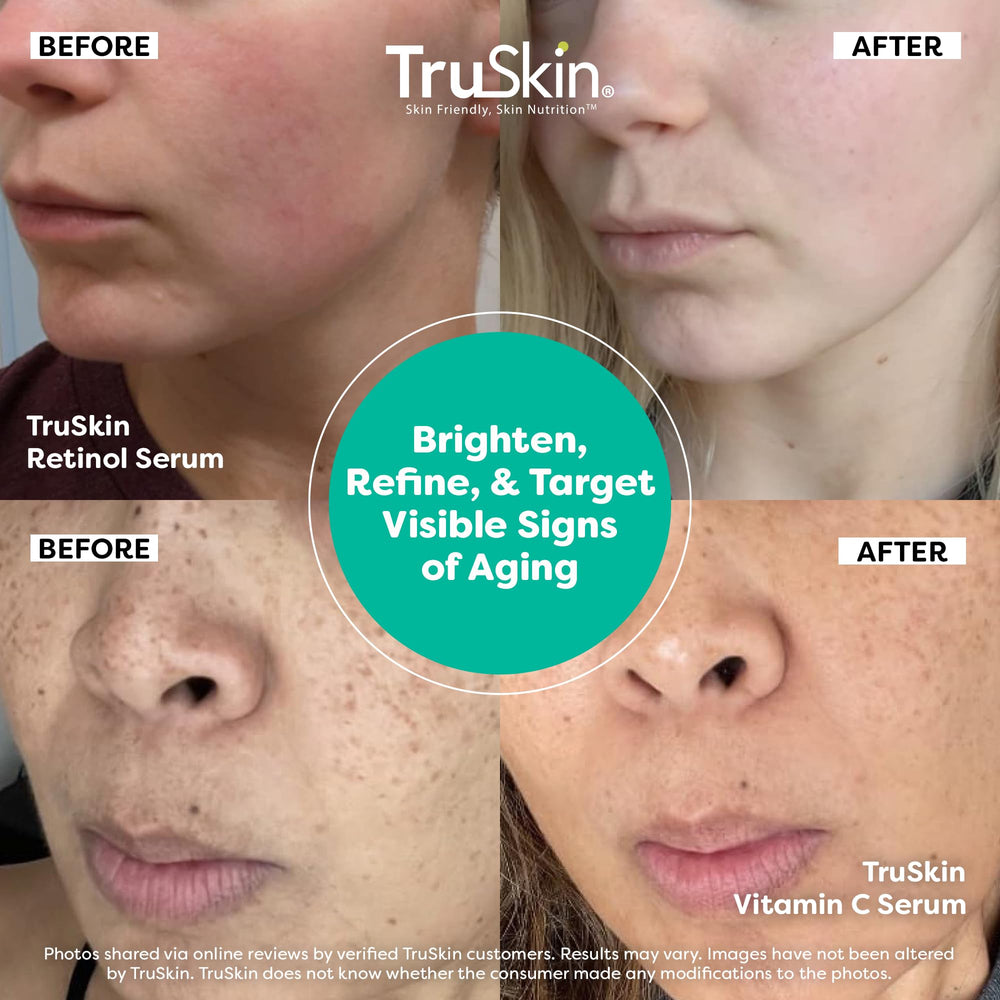 TruSkin serums in glass packaging convey premium skincare experience.