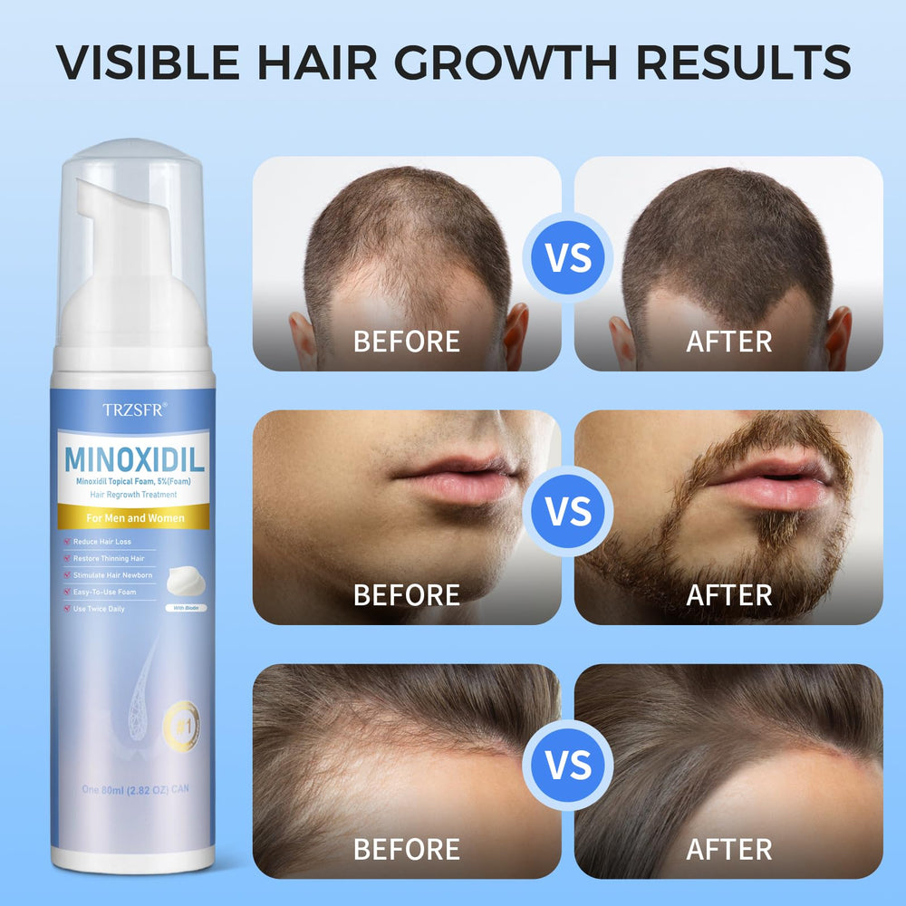 Trzsfr DHT-blocker formula icon suggests long-term support for healthier scalp.