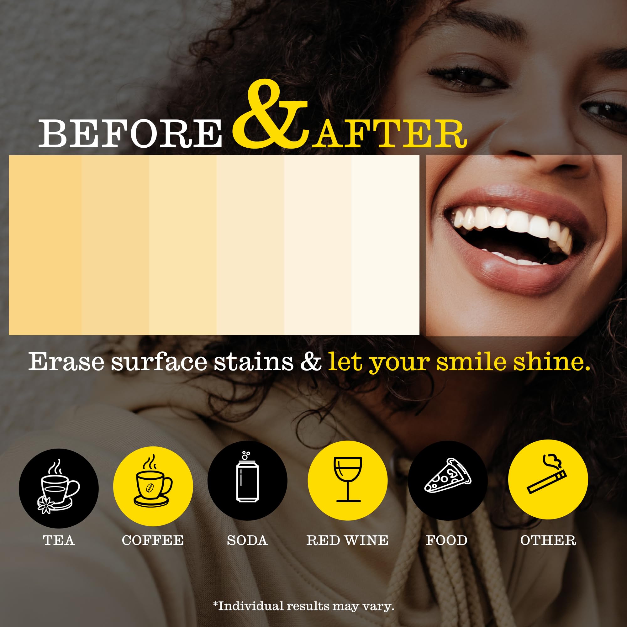 Close-up of strips on teeth during a 30-minute whitening session.
