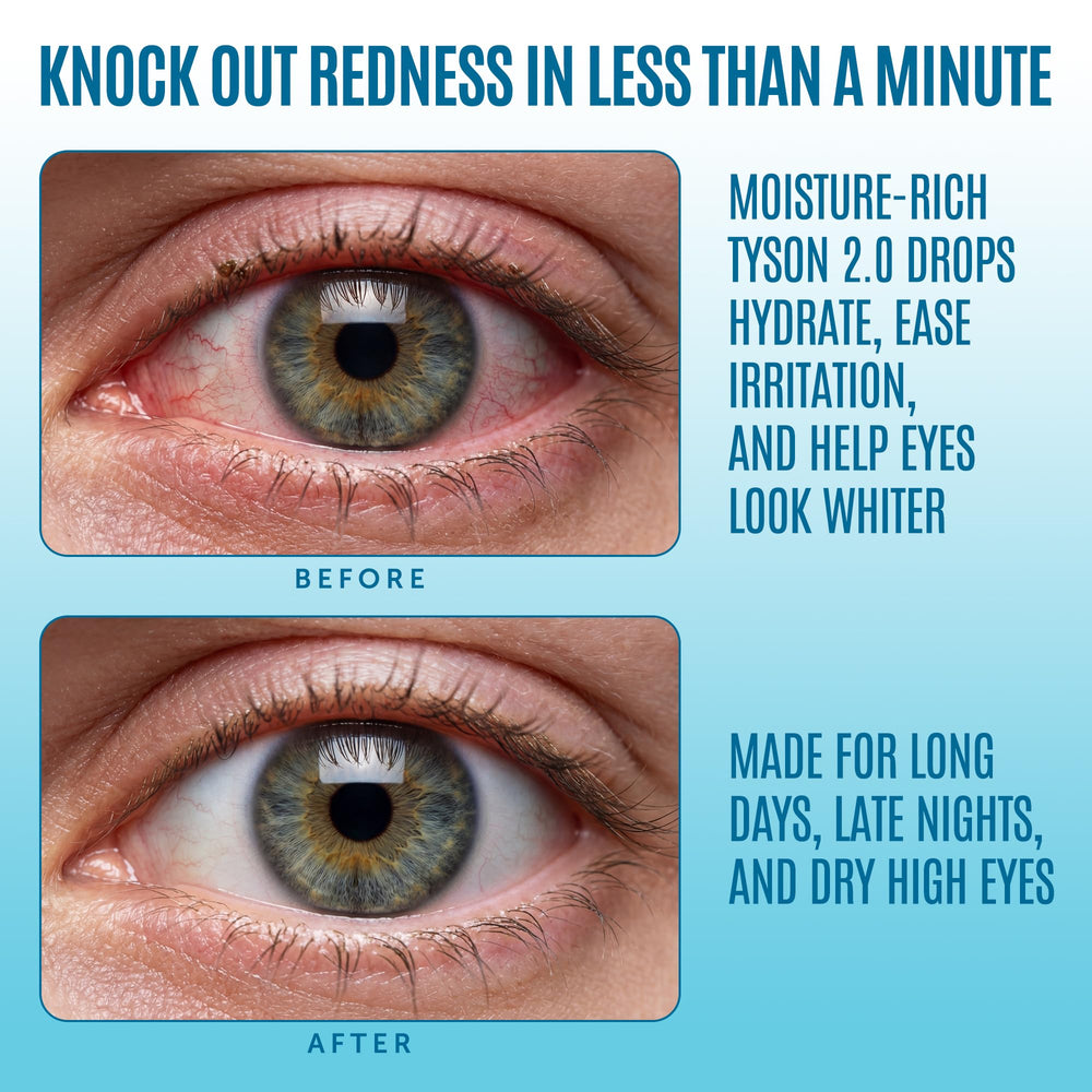 Tyson 2.0 Mike Red Eye Drops droplets ready to relieve dryness.