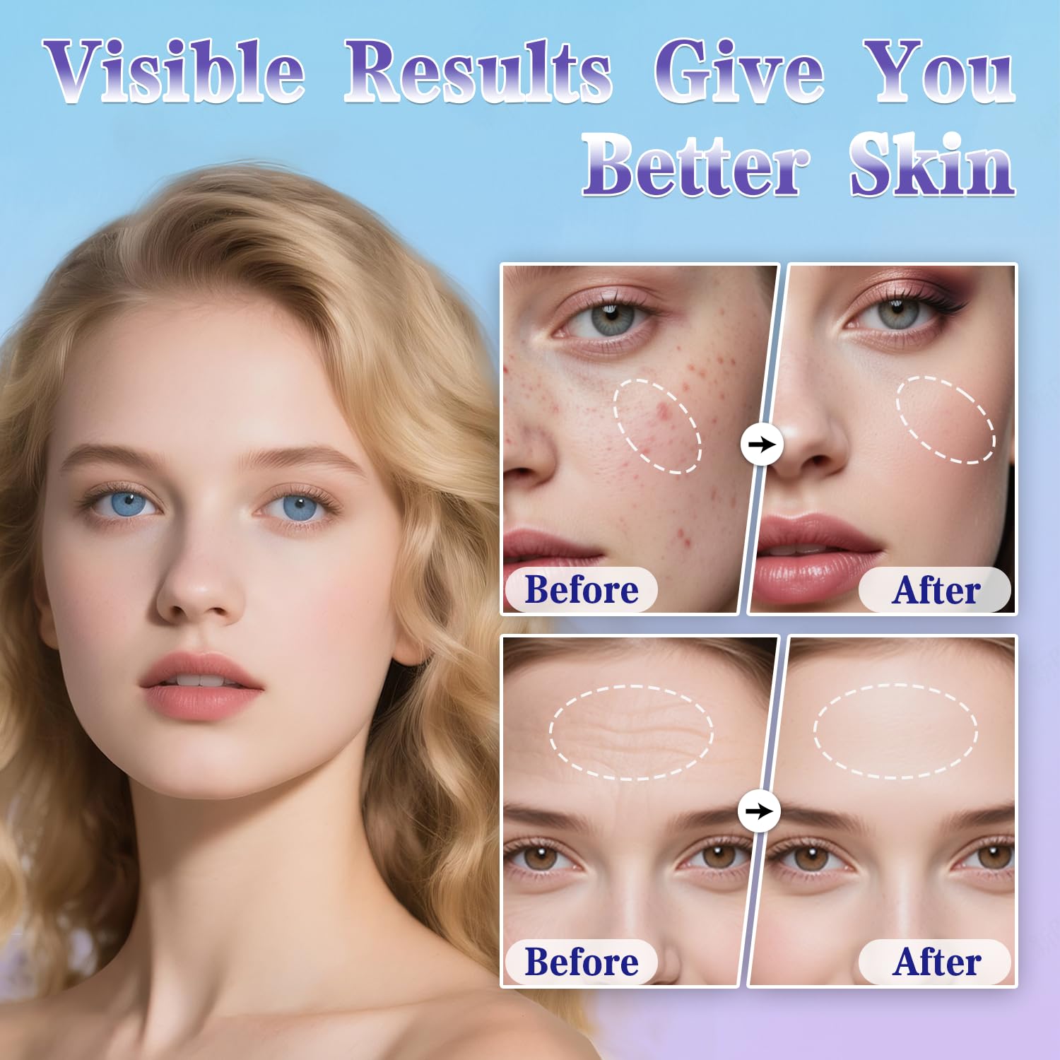 Uaike Derma Stamp for scalp: simple home use to stimulate circulation.