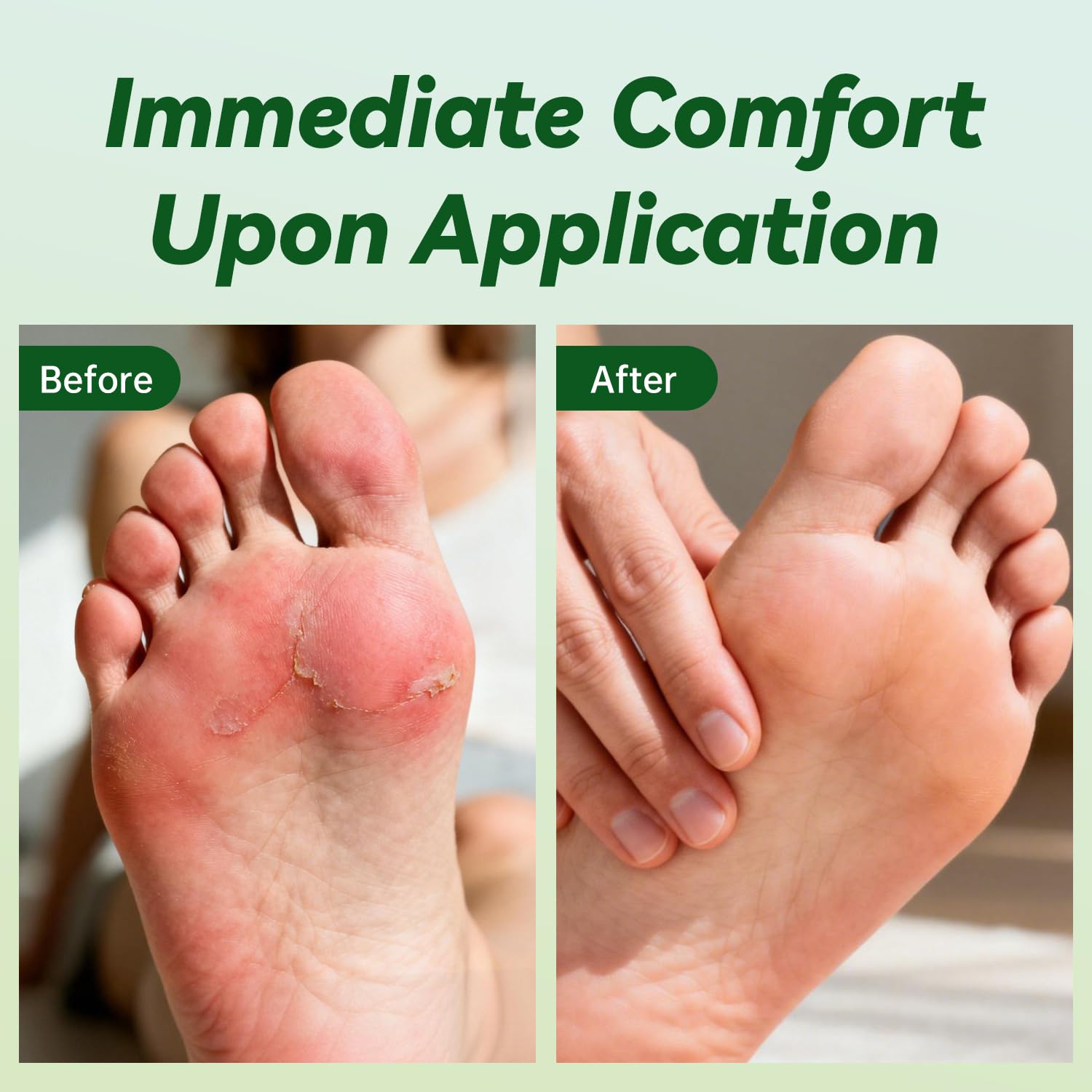 Ketoconozola Cream texture being absorbed quickly for a light feel.