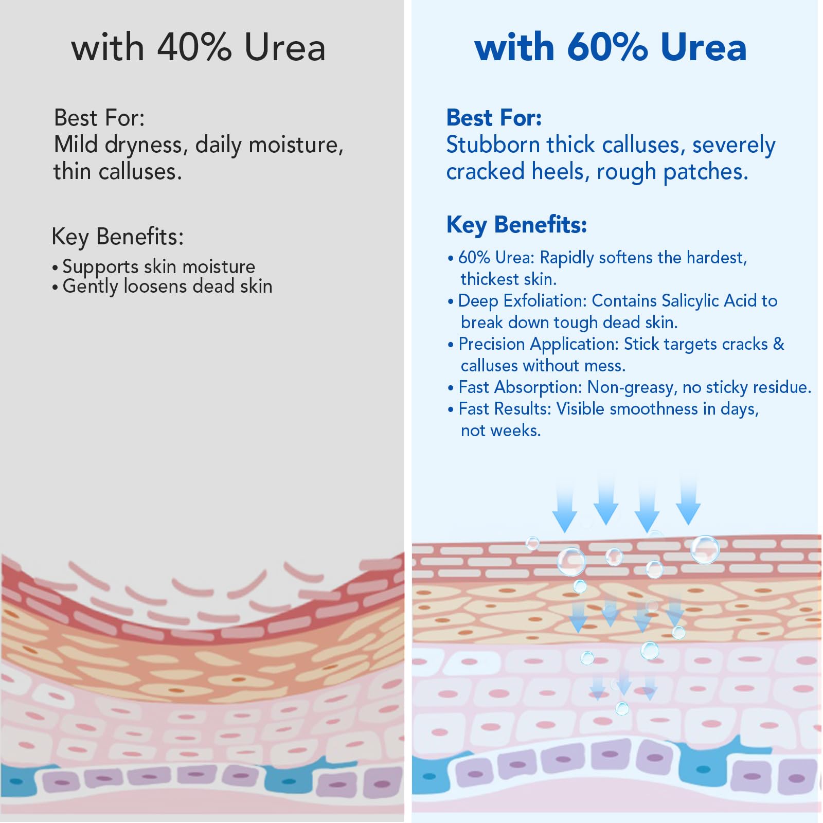 Urea Foot Care Stick nourishes dry skin for smoother feet.