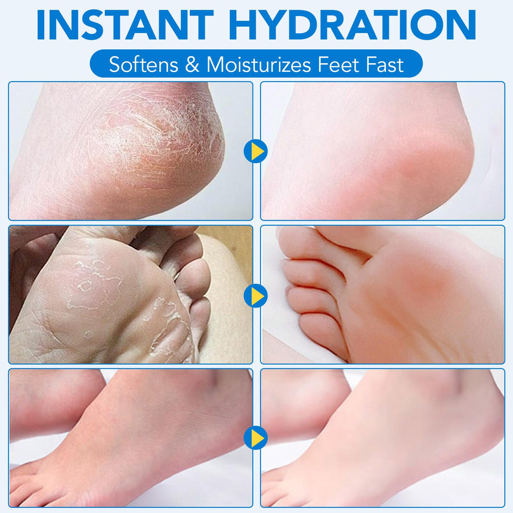 Uruses hydrating heel balm suitable for all skin types.