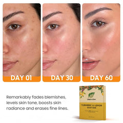Uselective lemon-turmeric glow soap bar kojic-acid ingredient highlights brightening potential.