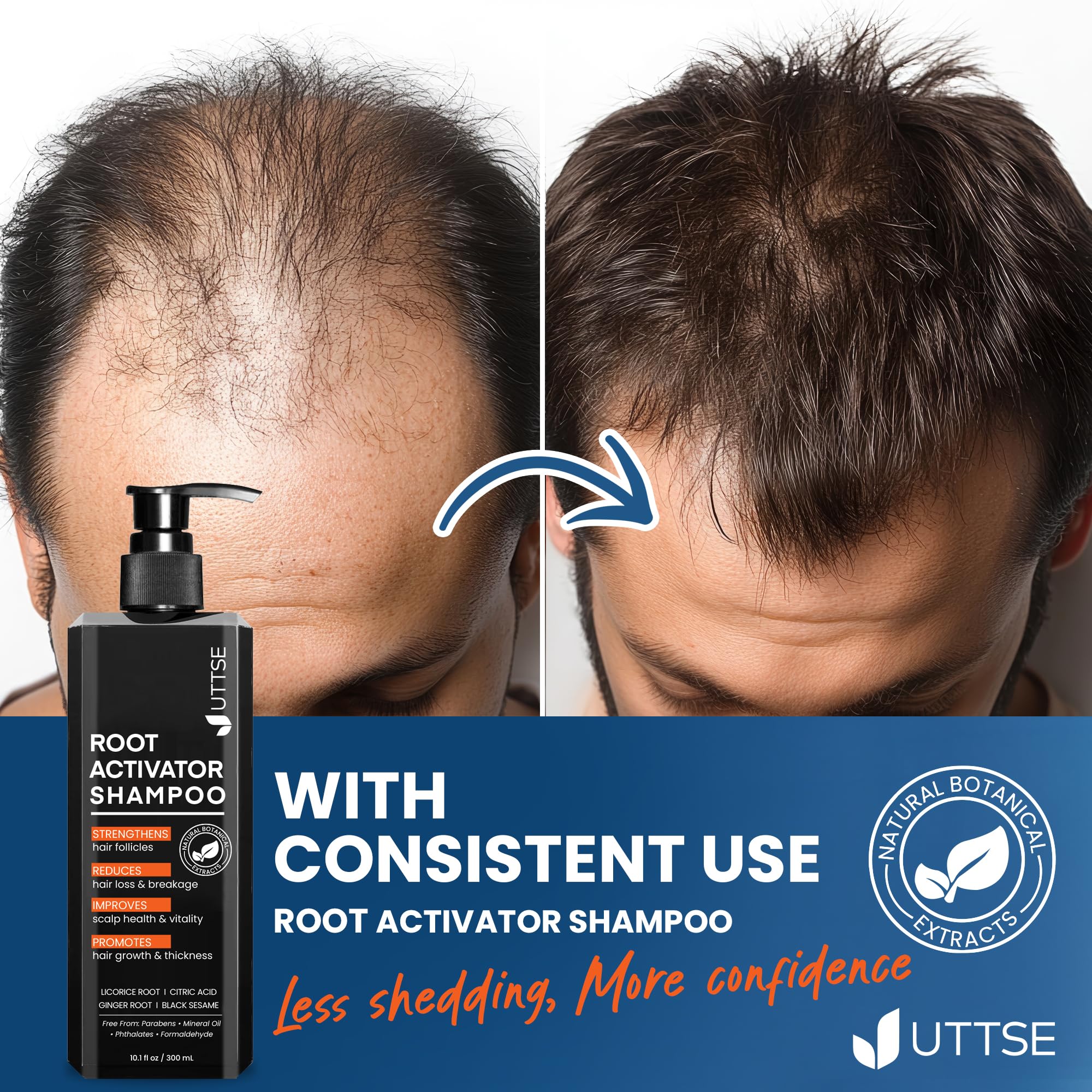 Uttse Root Activator Shampoo natural plant extracts highlight gentle care.