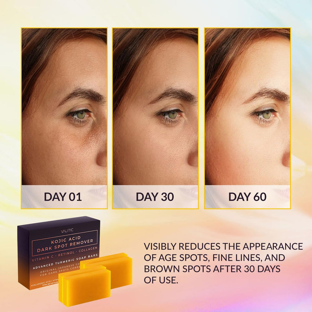 VALITIC Kojic Acid Soap Bar lather close-up highlights gentle daily cleansing benefits
