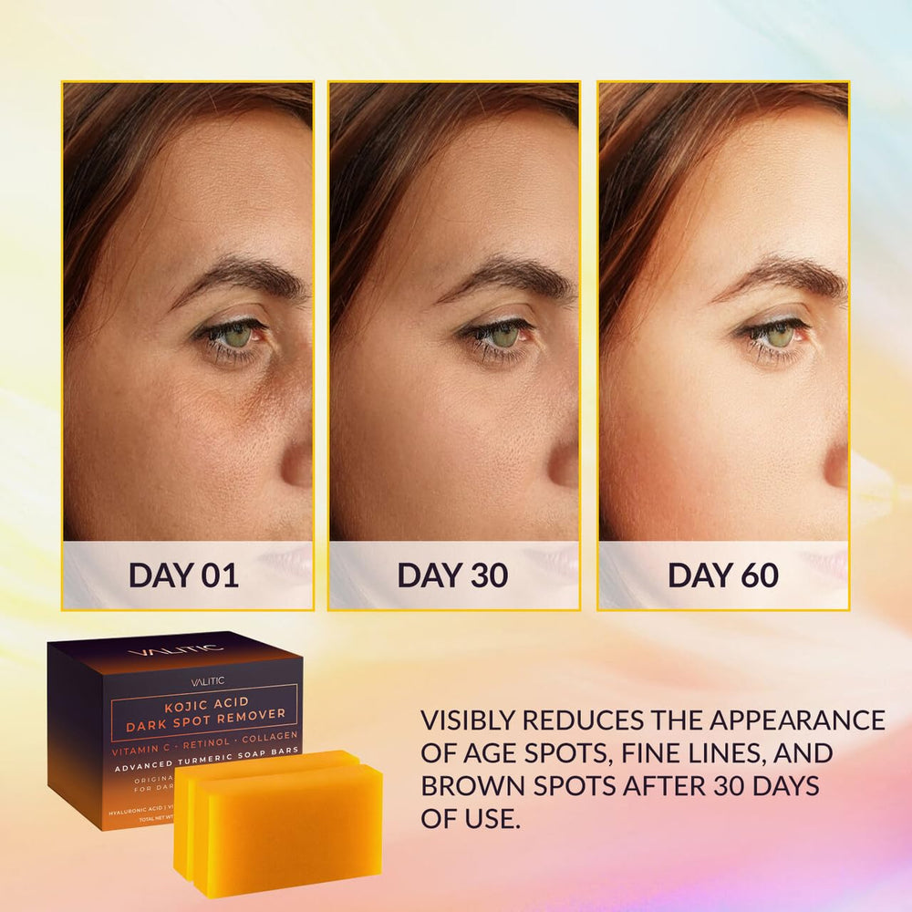 VALITIC Kojic Acid Soap Bar lather showing smooth cleansing and glow.
