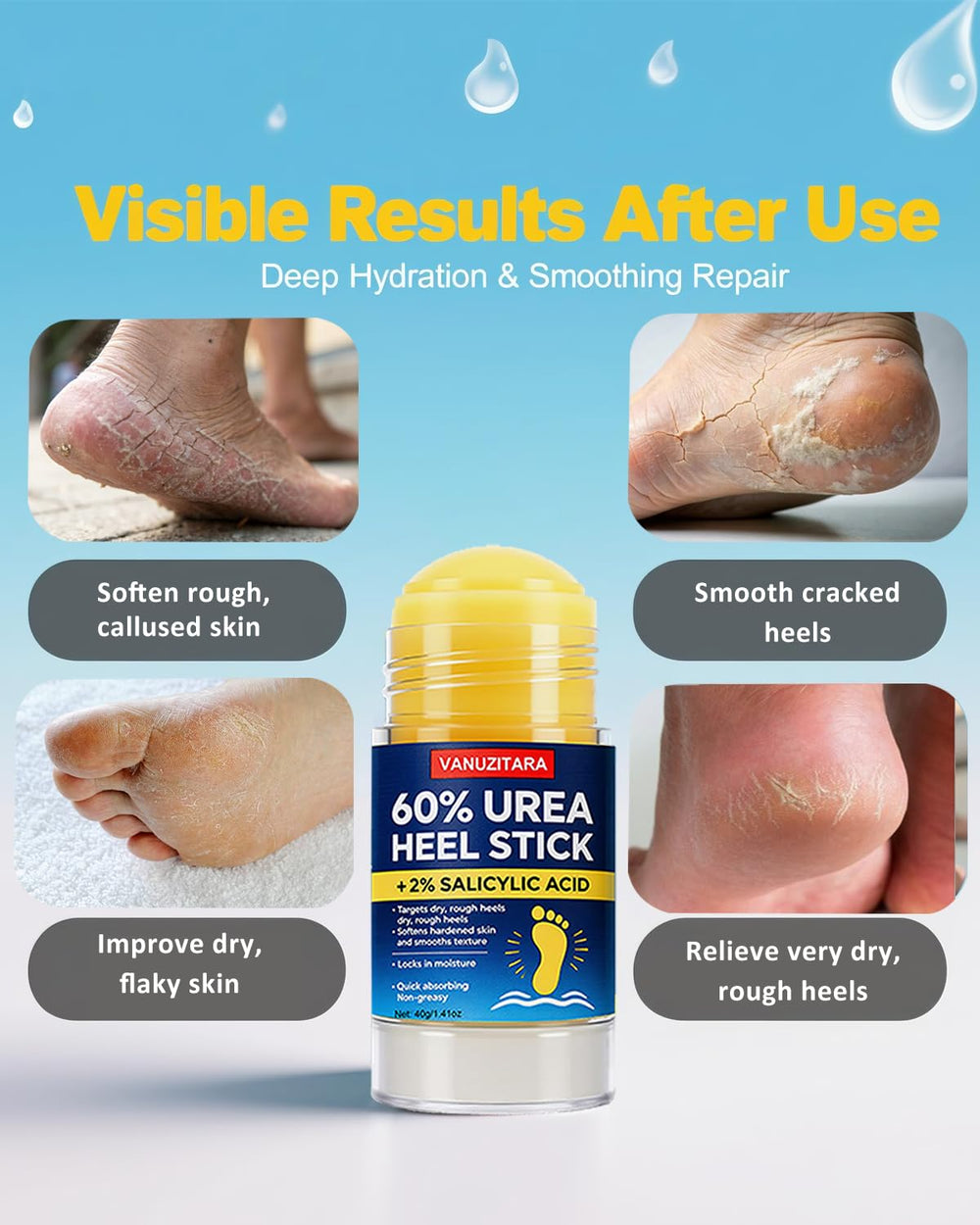VANUZITARA Stick-design application allows mess-free, targeted care.