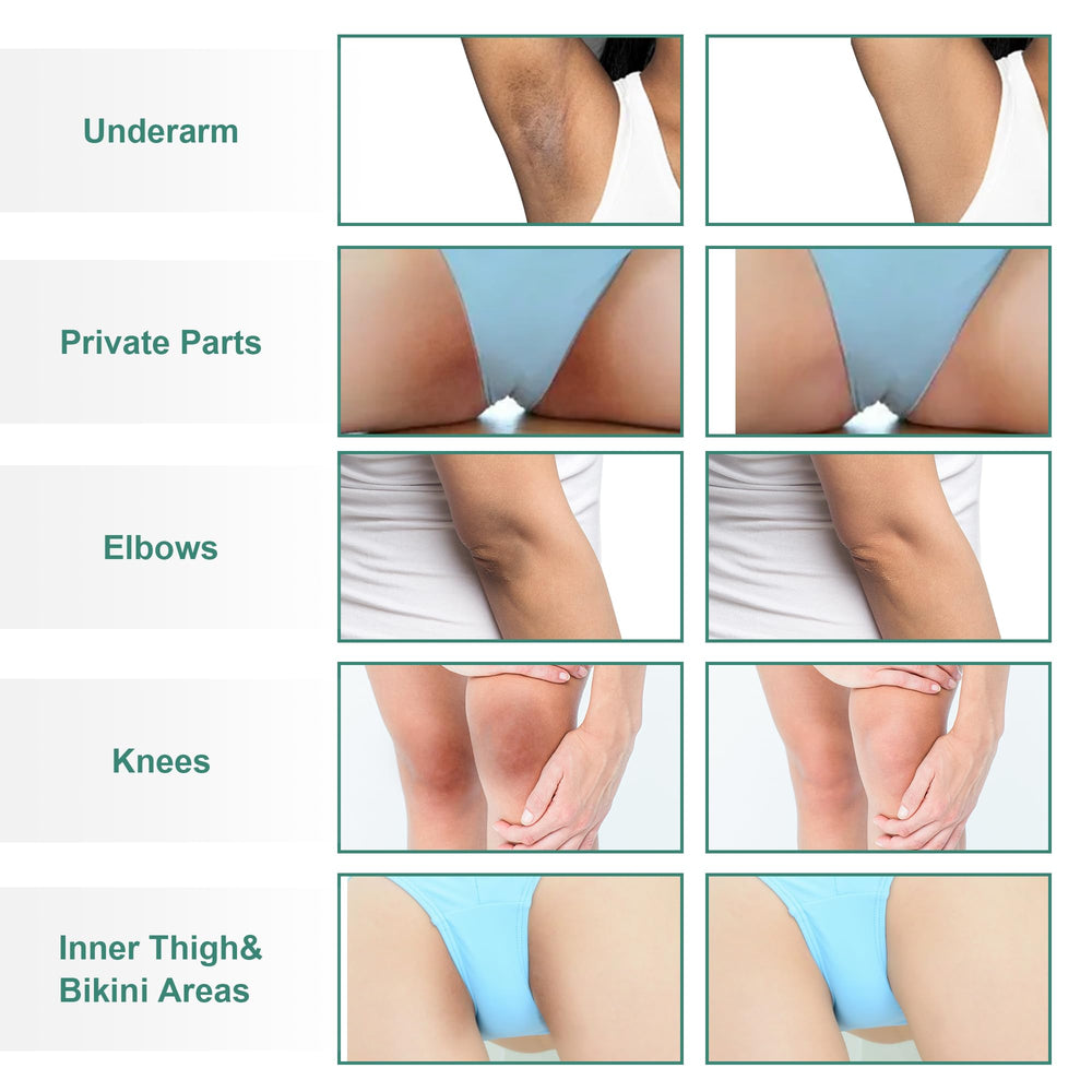 Vcetree underarm application scene demonstrates gentle use on sensitive skin