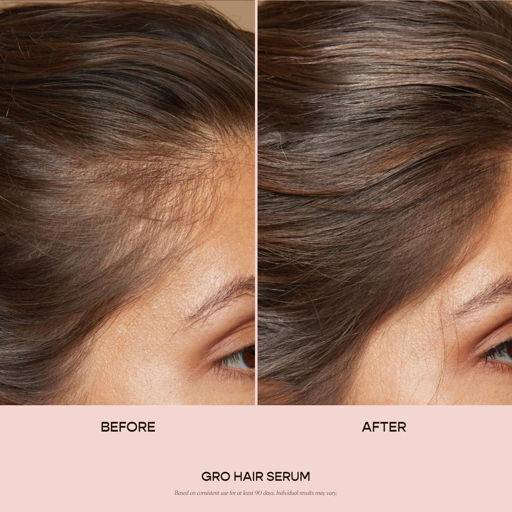 VEGAMOUR GRO Hair Serum dropper for daily scalp nourishment