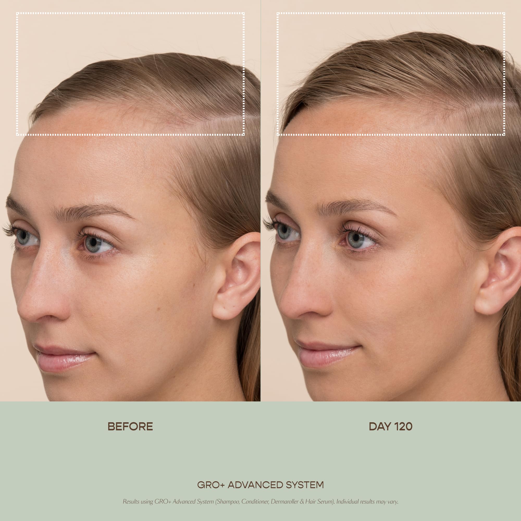 Scalp hydration ripple with VEGAMOUR GRO+ Balancing Conditioner visuals.