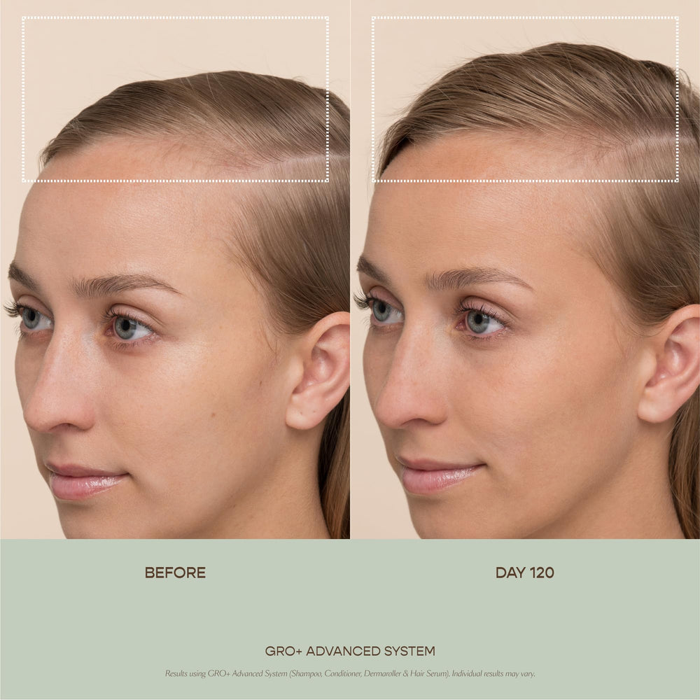 VEGAMOUR GRO+ daily-use routine scene emphasizes convenient scalp care